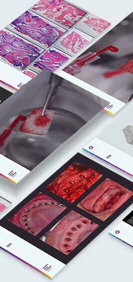 Transplante Celular Odontológico